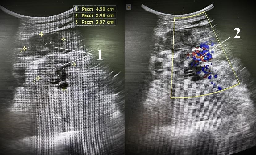 Изображение на обложке